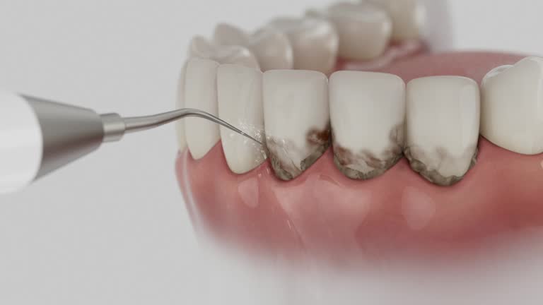 Trusted Teeth Cleaning And Checkup service in Emporia, VA - Dentist Open Now
